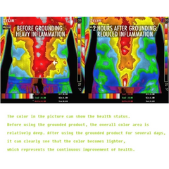 Thermal images highlighting torso inflammation with Silver Fiber Grounding Sheet
